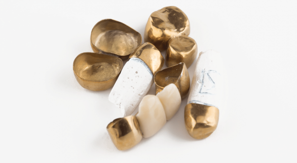 zahngold_verkaufen_hildesheim zahngold_verkaufen_hildesheim